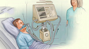 Ventilação mecânica invasiva e pneumonia associada a VM, sepse e choque séptico
